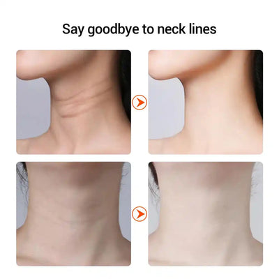 Before and after results of using EMS Facial Massager & Neck Lifter showing reduced neck lines and smoother skin texture.