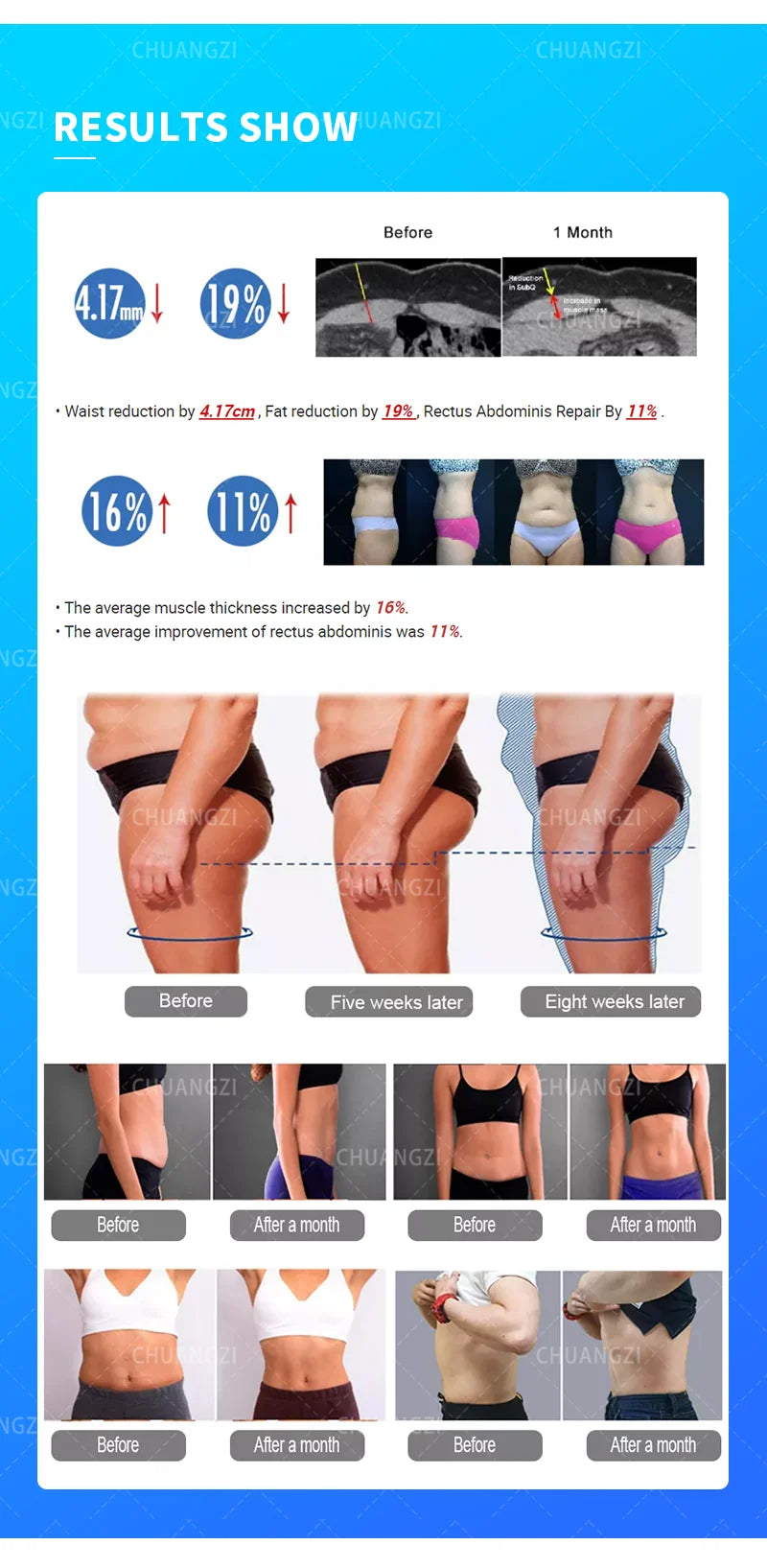 New EMS 2 in 1 Roller Massage Lose Weight Therapy 40K Compressive Micro vibration Vacuum 5D Body slimming Machine - PrimeandBeauty