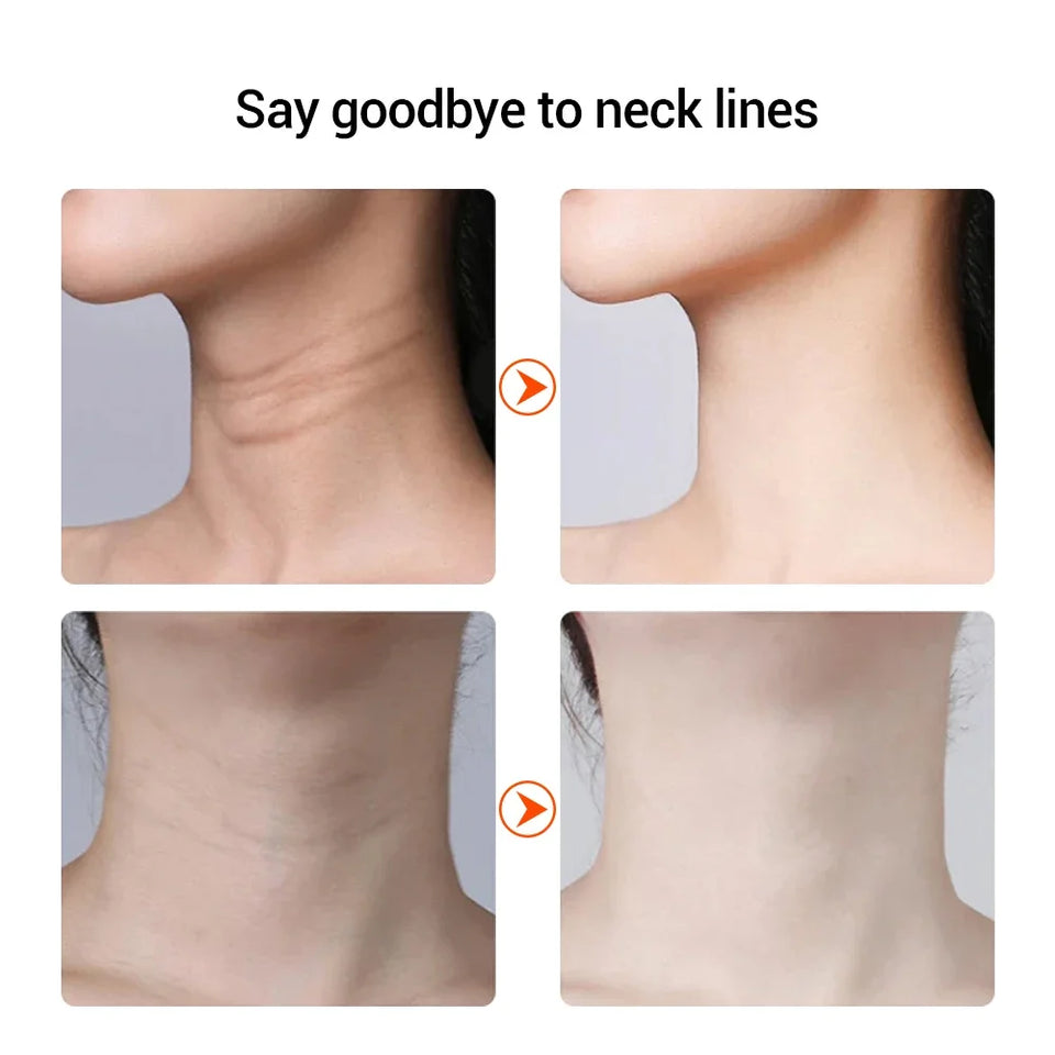 Emeka Neck Beauty Device EMS Microcurrent Chin Facial Lifting LED Firming Rejuvenation Anti Wrinkle Skin Care Face Massager