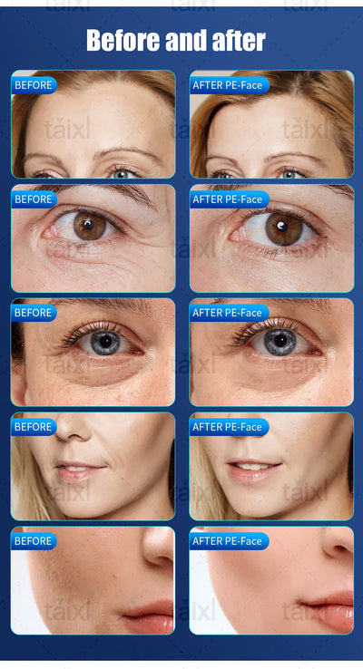 EMS High Intensity Neo Electromagnetic Slimming Latest Neo Nova Sculpt Muscle Stimulator - PrimeandBeauty