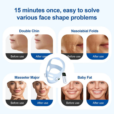 Microcurrent Chin Lift Massager