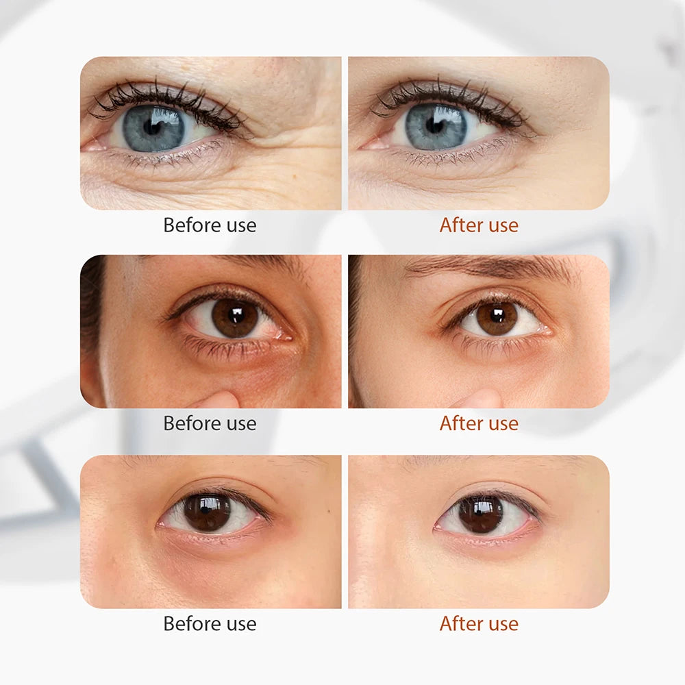 EMS Red Light Eye Massager – Anti-Wrinkle & Dark Circle Remover